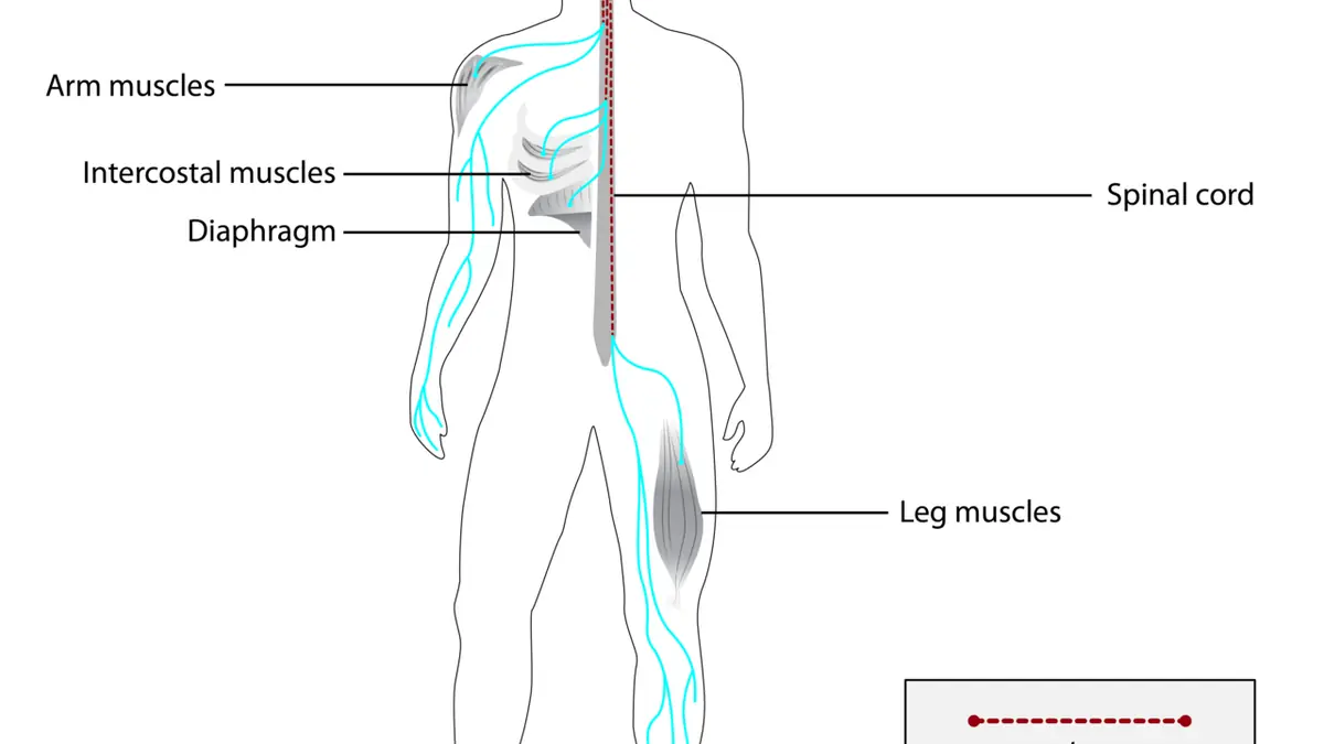 Military veterans twice as likely to develop ALS, researchers seek answers